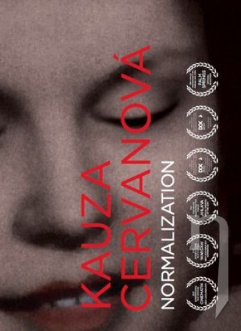 DVD Film - Kauza Cervanová