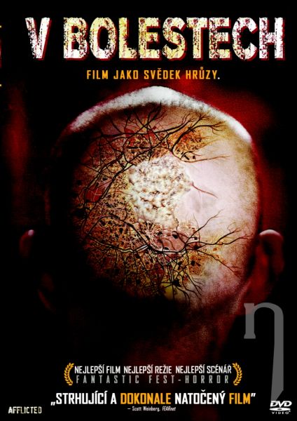 DVD Film - V bolestech