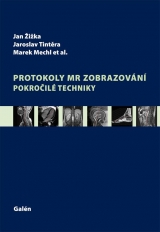 Kniha - Protokoly MR zobrazování - Pokročilé techniky